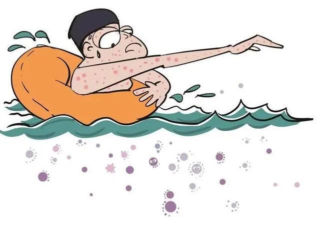 1756801358893033.jpeg 游泳池細(xì)菌2.jpeg